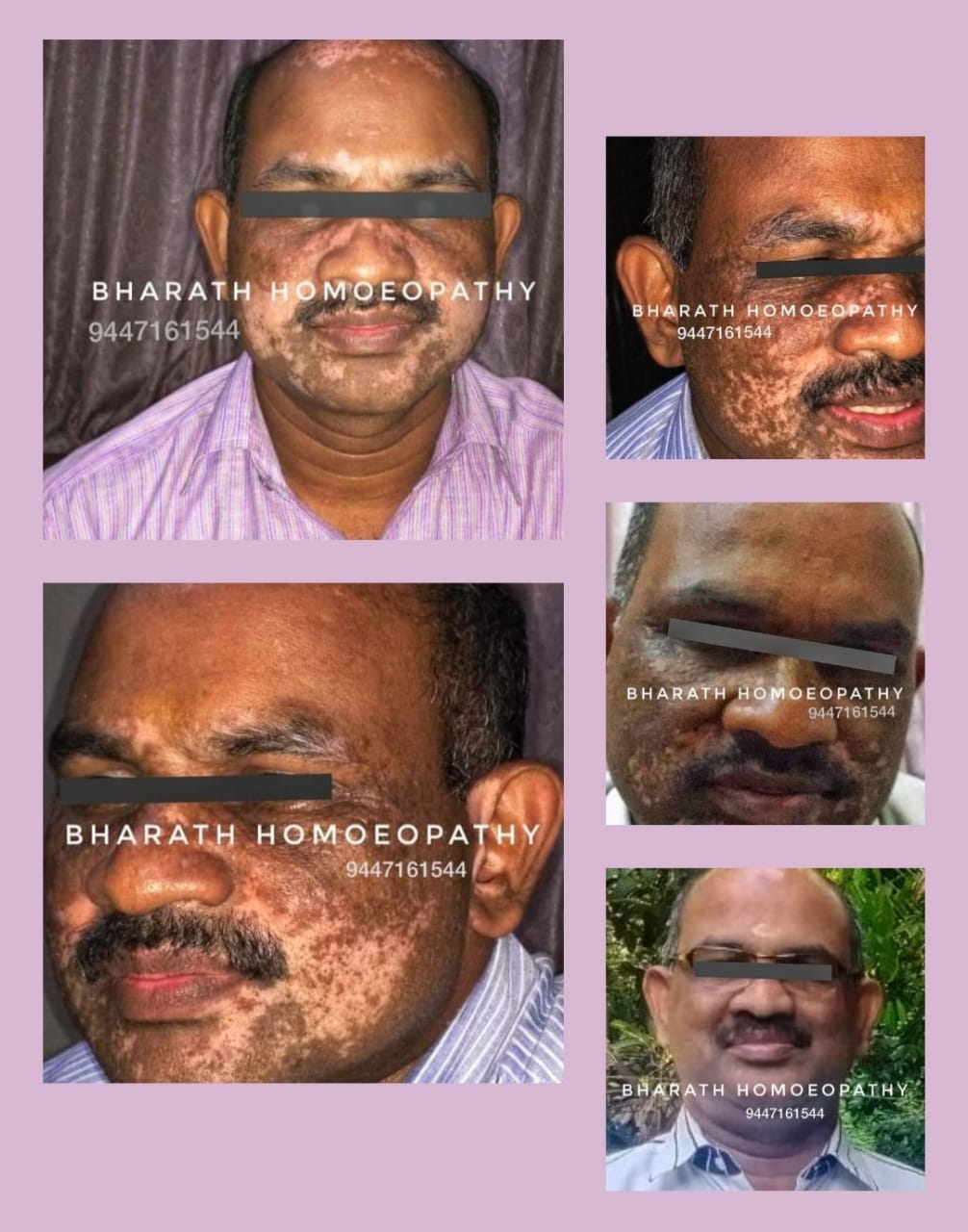 BHARATH  HOMOEOPATHY MULTI SPECIALITY CLINIC