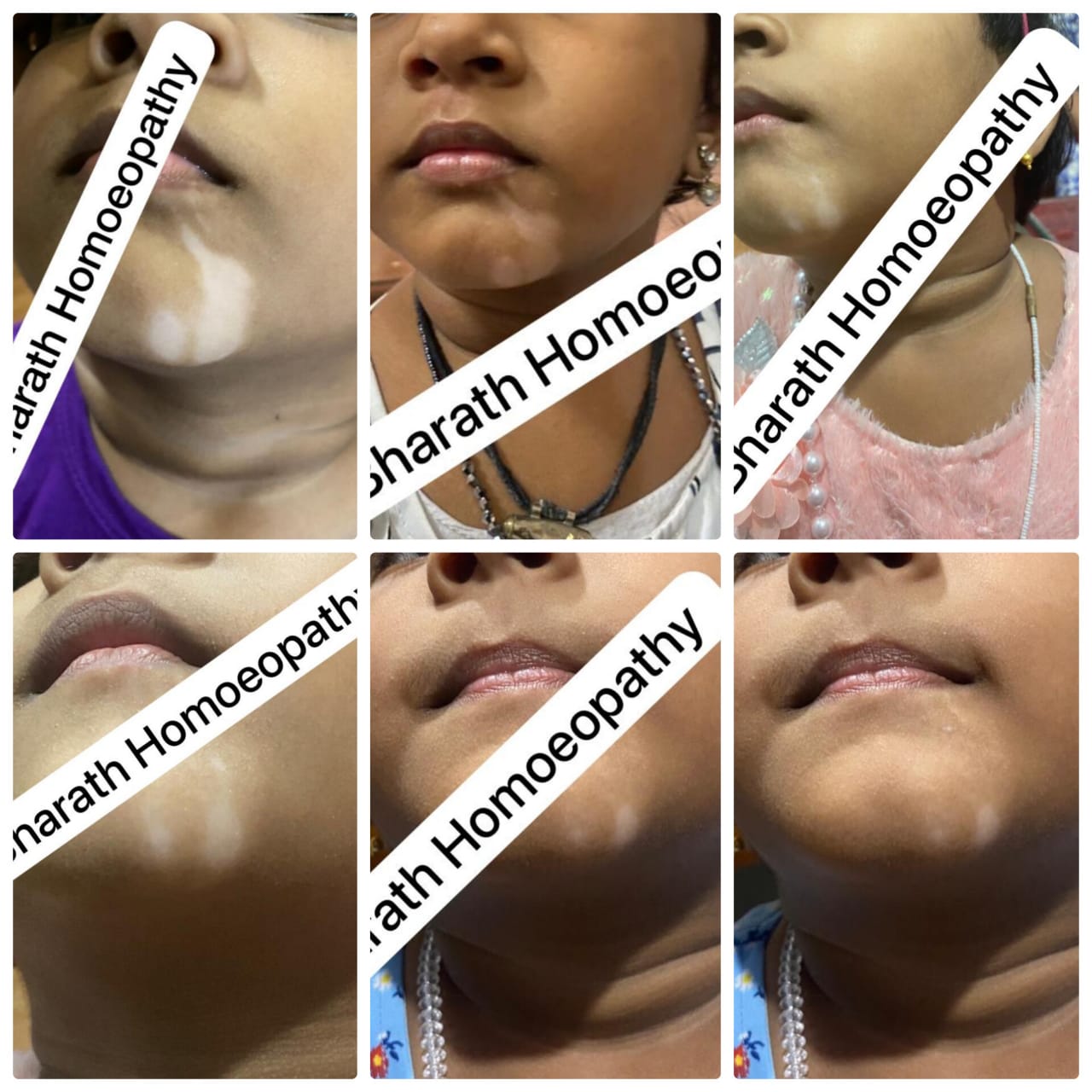 BHARATH  HOMOEOPATHY MULTI SPECIALITY CLINIC